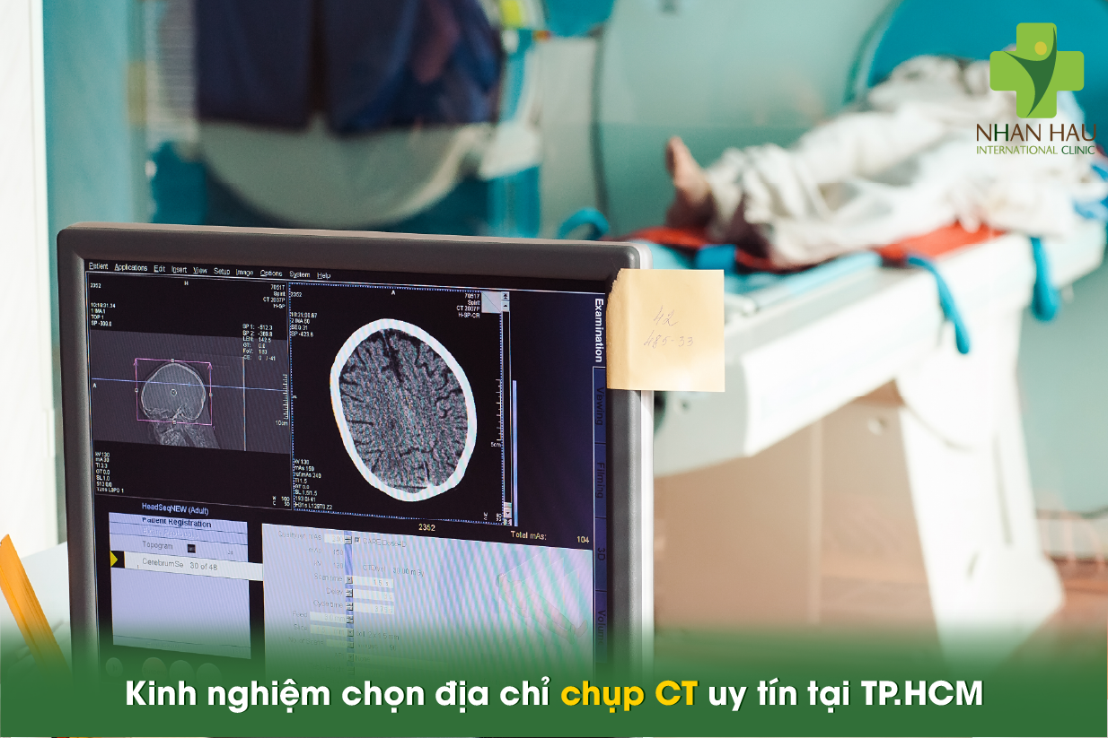 Chụp CT giá bao nhiêu? Bảng giá chi tiết và cách tiết kiệm chi phí 8 Kinh nghiệm chọn địa chỉ chụp CT uy tín tại TP.HCM