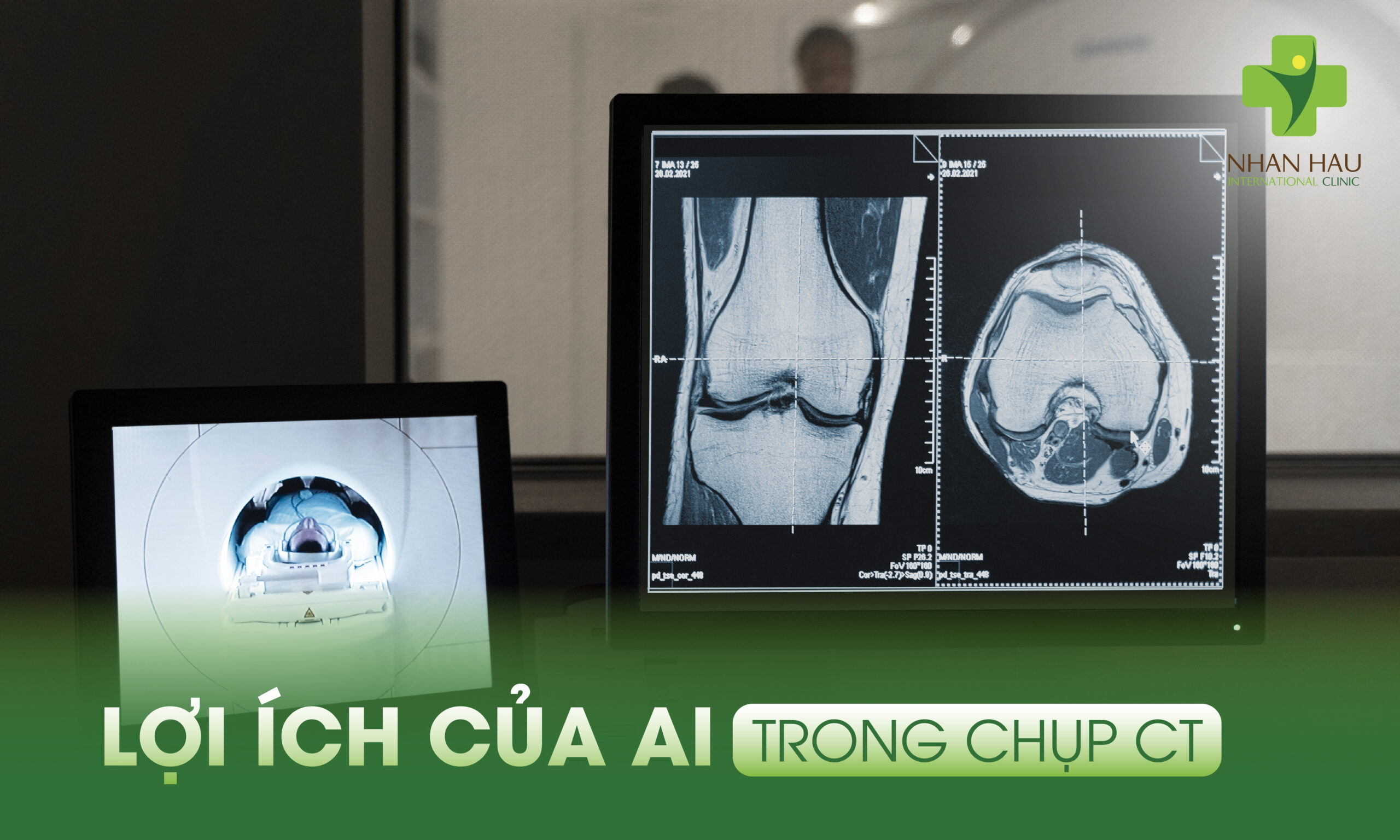 Chụp CT và Công nghệ AI: Cách Mạng Chẩn Đoán Hình Ảnh Y Khoa 3 Lợi Ích Của AI Trong Chụp CT