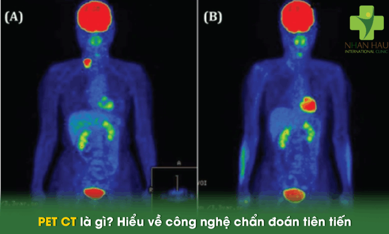 PET CT là gì? Hiểu về công nghệ chẩn đoán tiên tiến