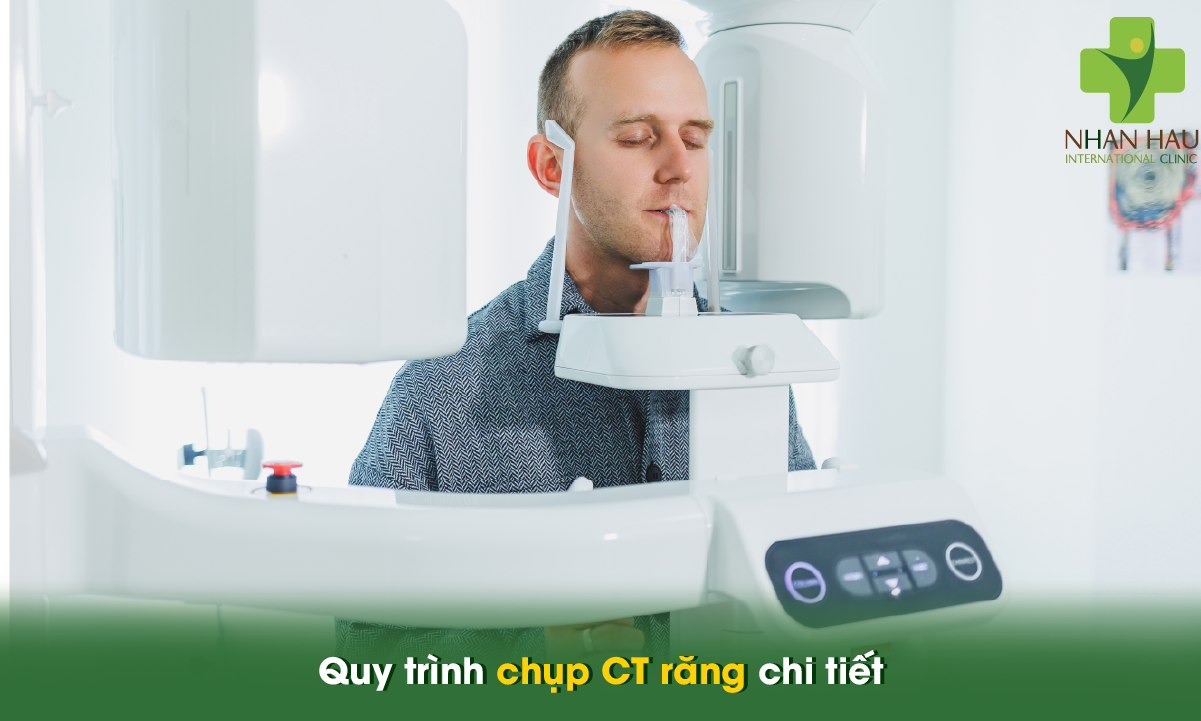 Chụp CT răng: Công nghệ chẩn đoán an toàn và chính xác trong nha khoa 4 Quy trình chụp CT răng chi tiết