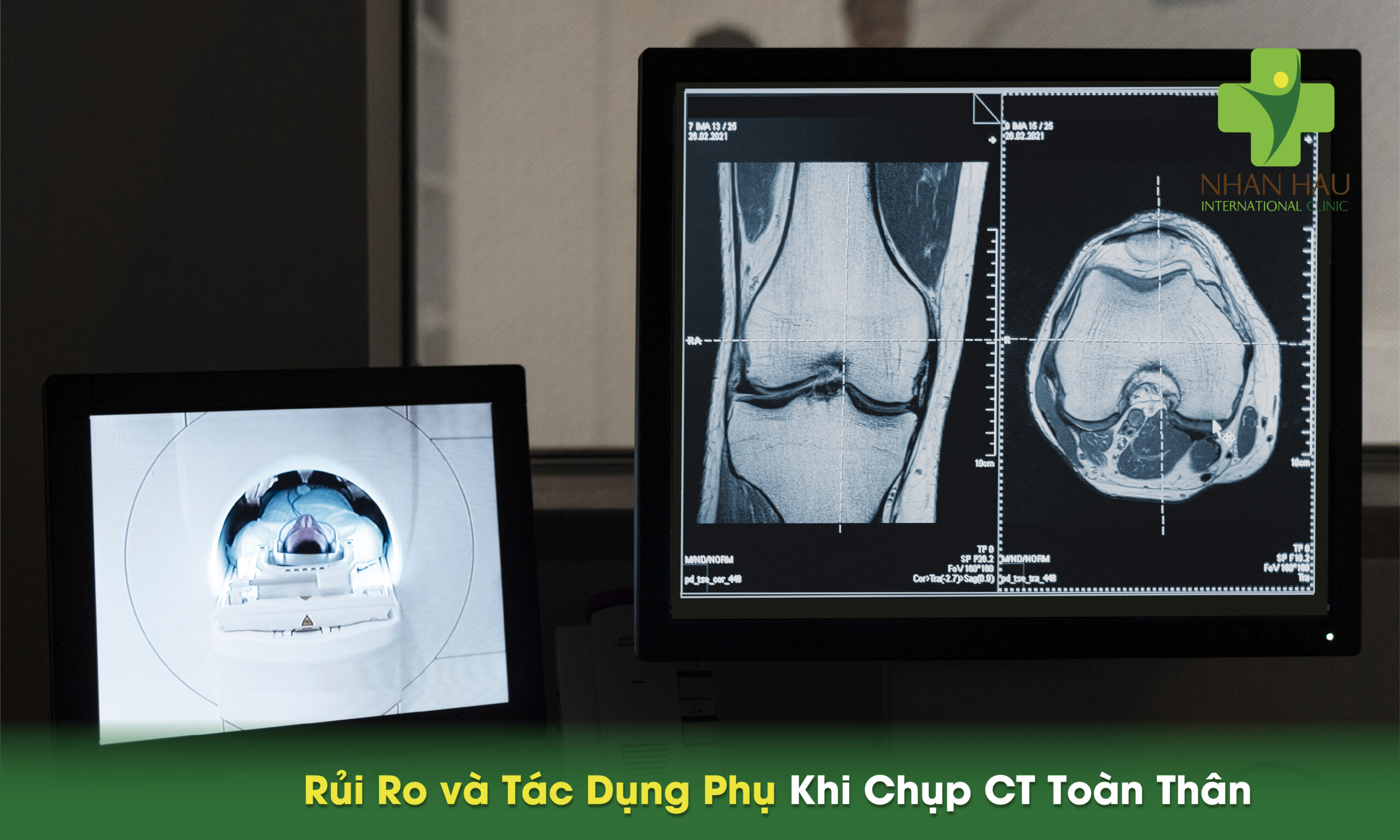 Chụp CT Toàn Thân: Khi Nào Cần Thiết và Những Điều Cần Biết 6 Rủi Ro và Tác Dụng Phụ Khi Chụp CT Toàn Thân