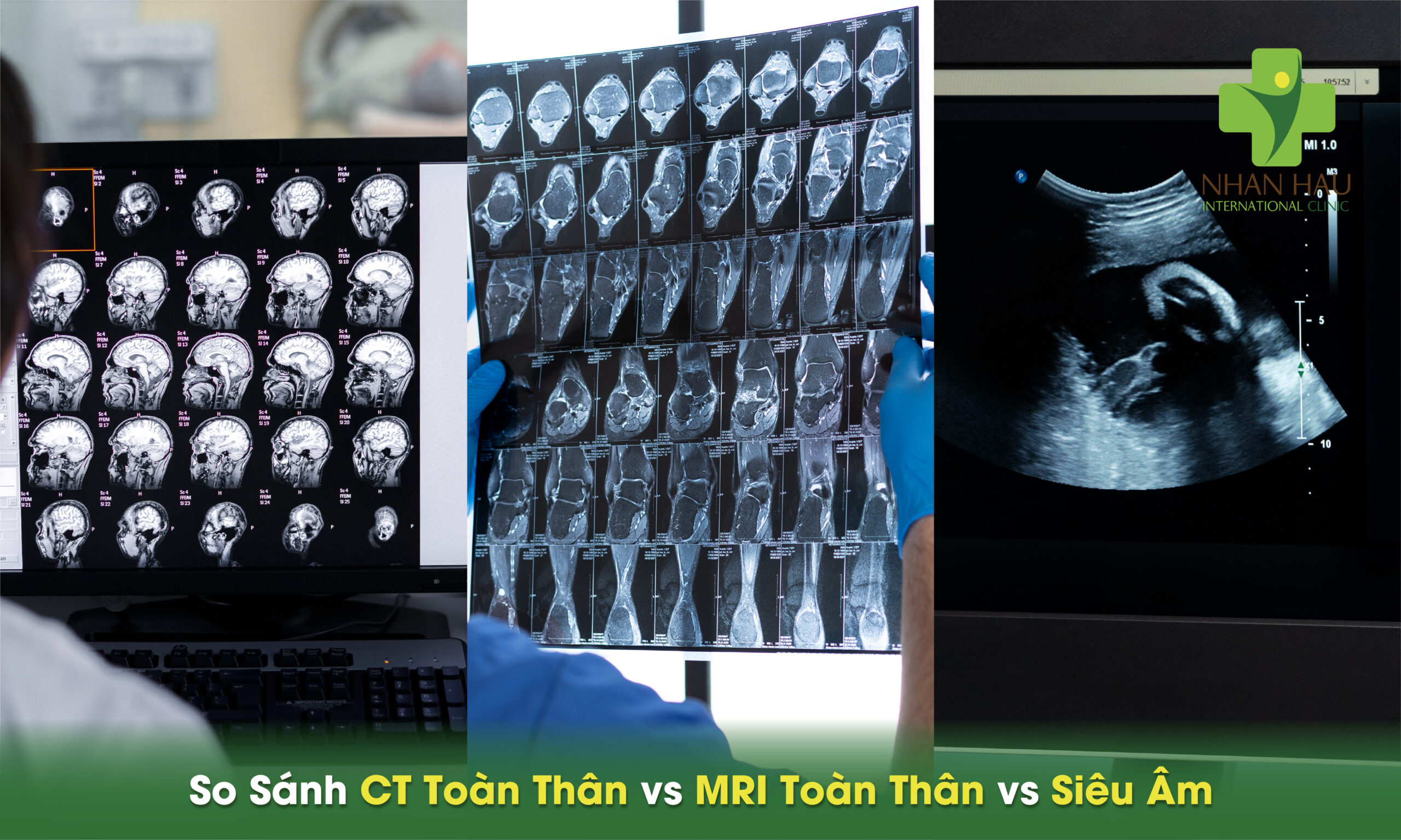 Chụp CT Toàn Thân: Khi Nào Cần Thiết và Những Điều Cần Biết 7 So Sánh CT Toàn Thân vs MRI Toàn Thân vs Siêu Âm