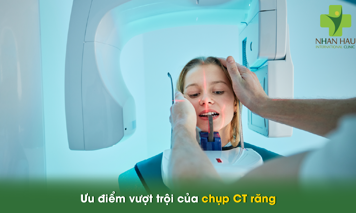 Chụp CT răng: Công nghệ chẩn đoán an toàn và chính xác trong nha khoa 2 Ưu điểm vượt trội của chụp CT răng