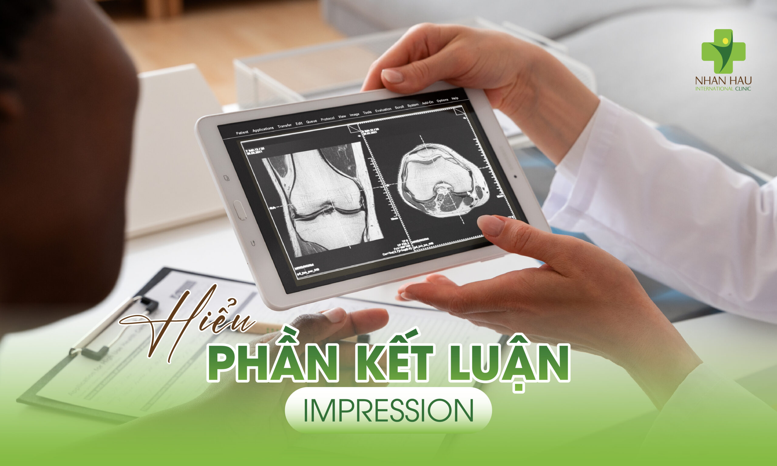 Hiểu Phần Kết Luận (Impression)