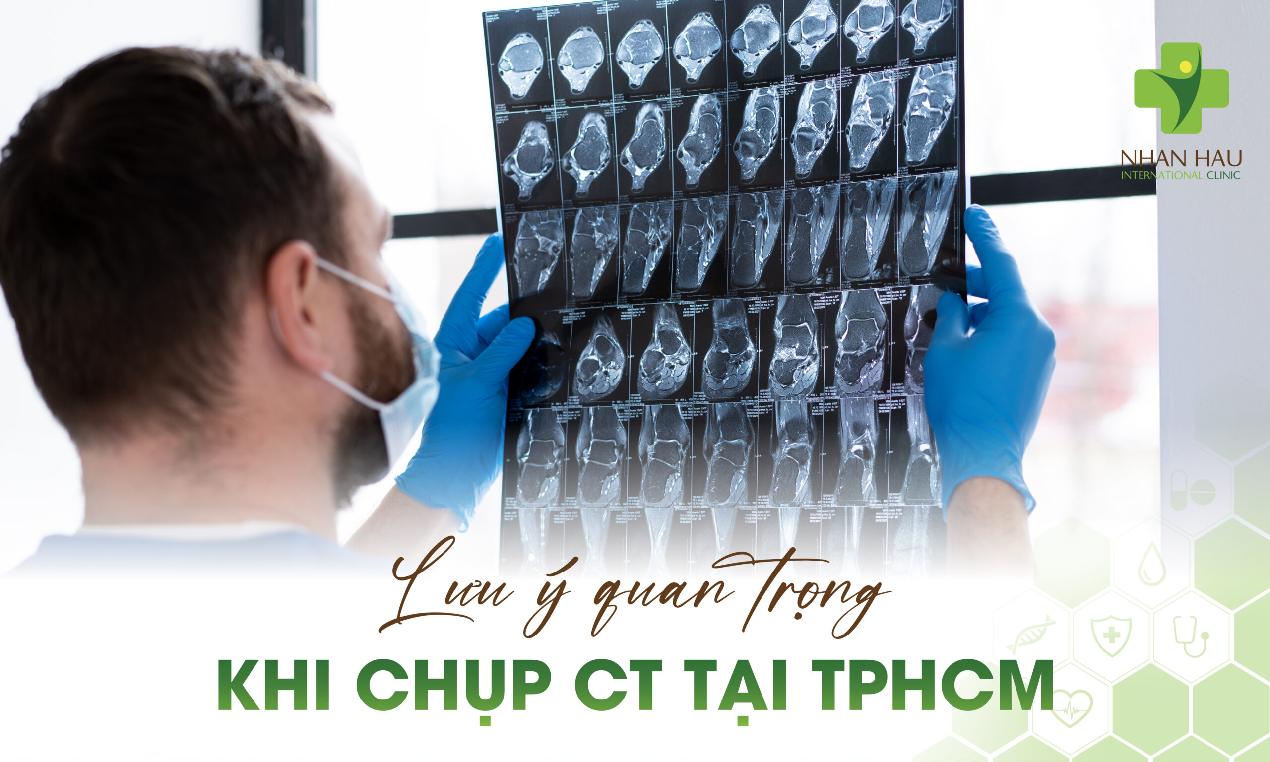 Lưu ý quan trọng khi chụp CT tại TP.HCM