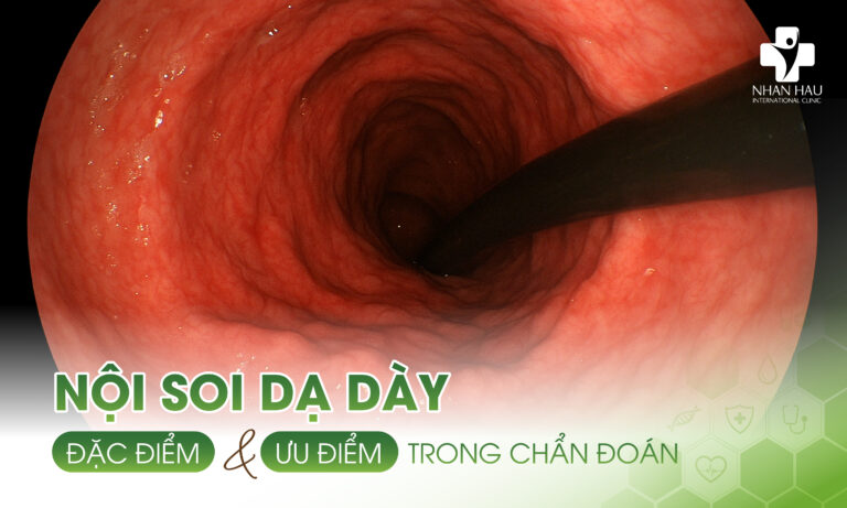 Nội soi dạ dày: Đặc điểm và ưu điểm trong chẩn đoán