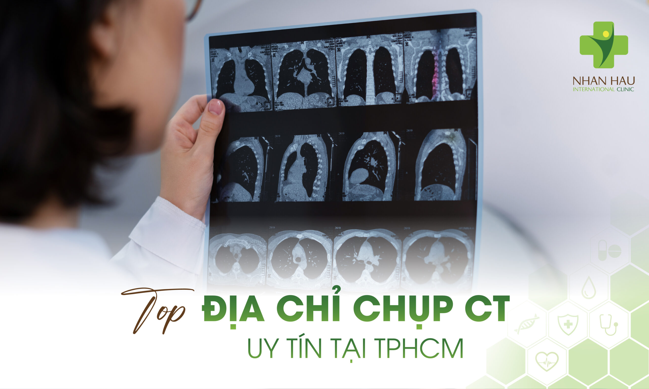 Top địa chỉ chụp CT uy tín tại TP.HCM