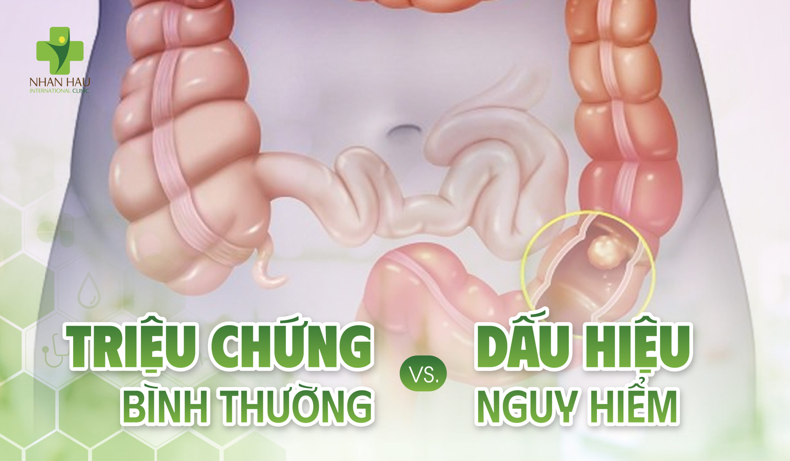 Chăm Sóc Sau Khi Nội Soi Đại Tràng: Hướng Dẫn Toàn Diện Từ A-Z 4 Triệu Chứng Bình Thường vs. Dấu Hiệu Nguy Hiểm