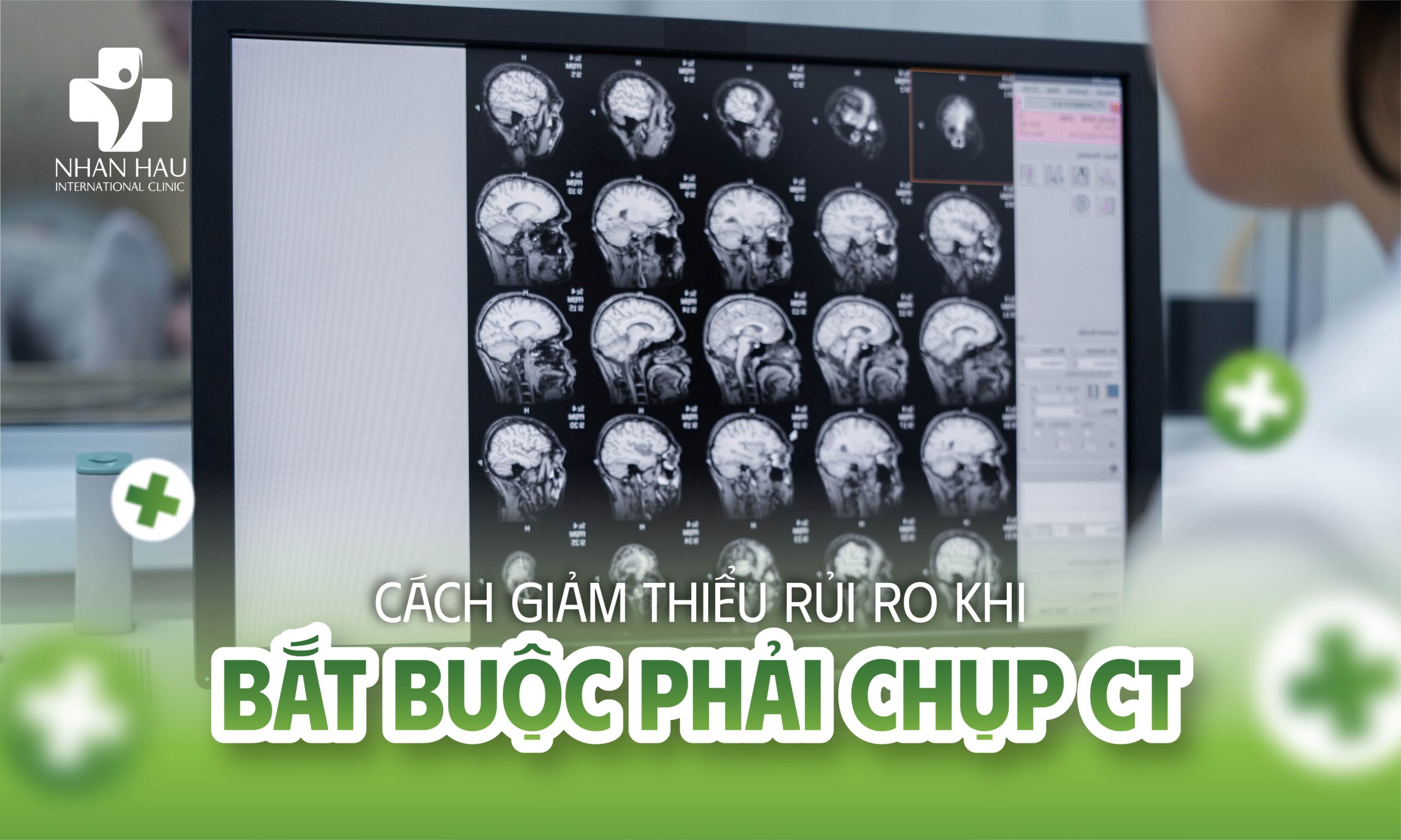 Có Nên Chụp CT Não Cho Trẻ? Hướng Dẫn Toàn Diện Cho Phụ Huynh 5 Cách Giảm Thiểu Rủi Ro Khi Bắt Buộc Phải Chụp CT