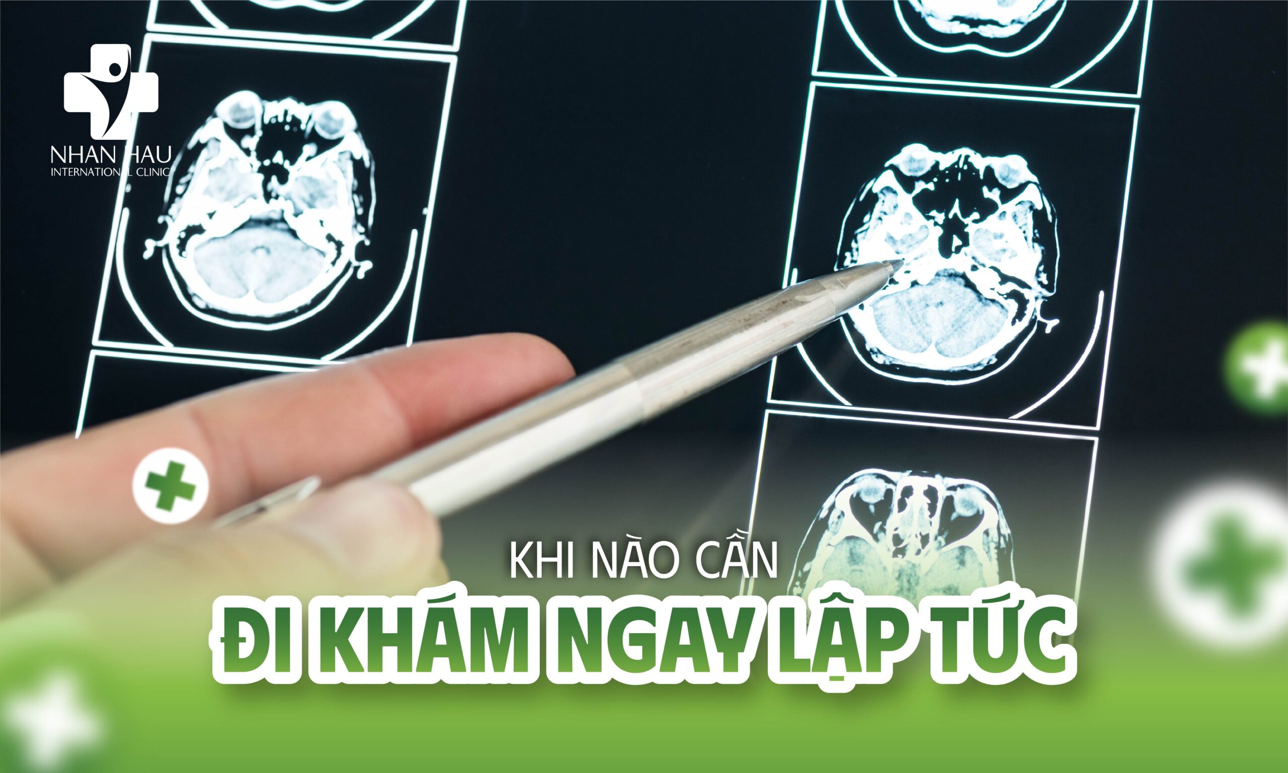 Có Nên Chụp CT Não Cho Trẻ? Hướng Dẫn Toàn Diện Cho Phụ Huynh 3 Khi Nào Thực Sự Cần Chụp CT Não Cho Trẻ?