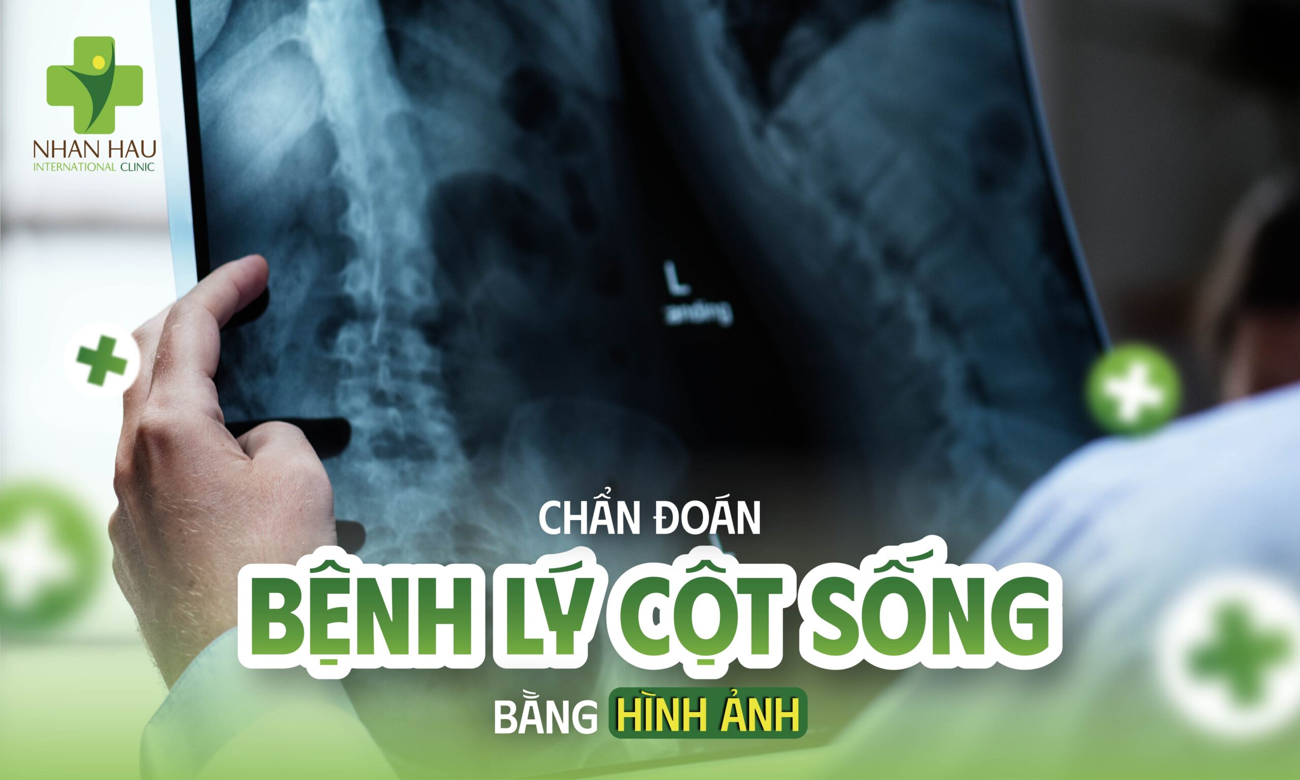 Chẩn Đoán Bệnh Lý Cột Sống Bằng Hình Ảnh