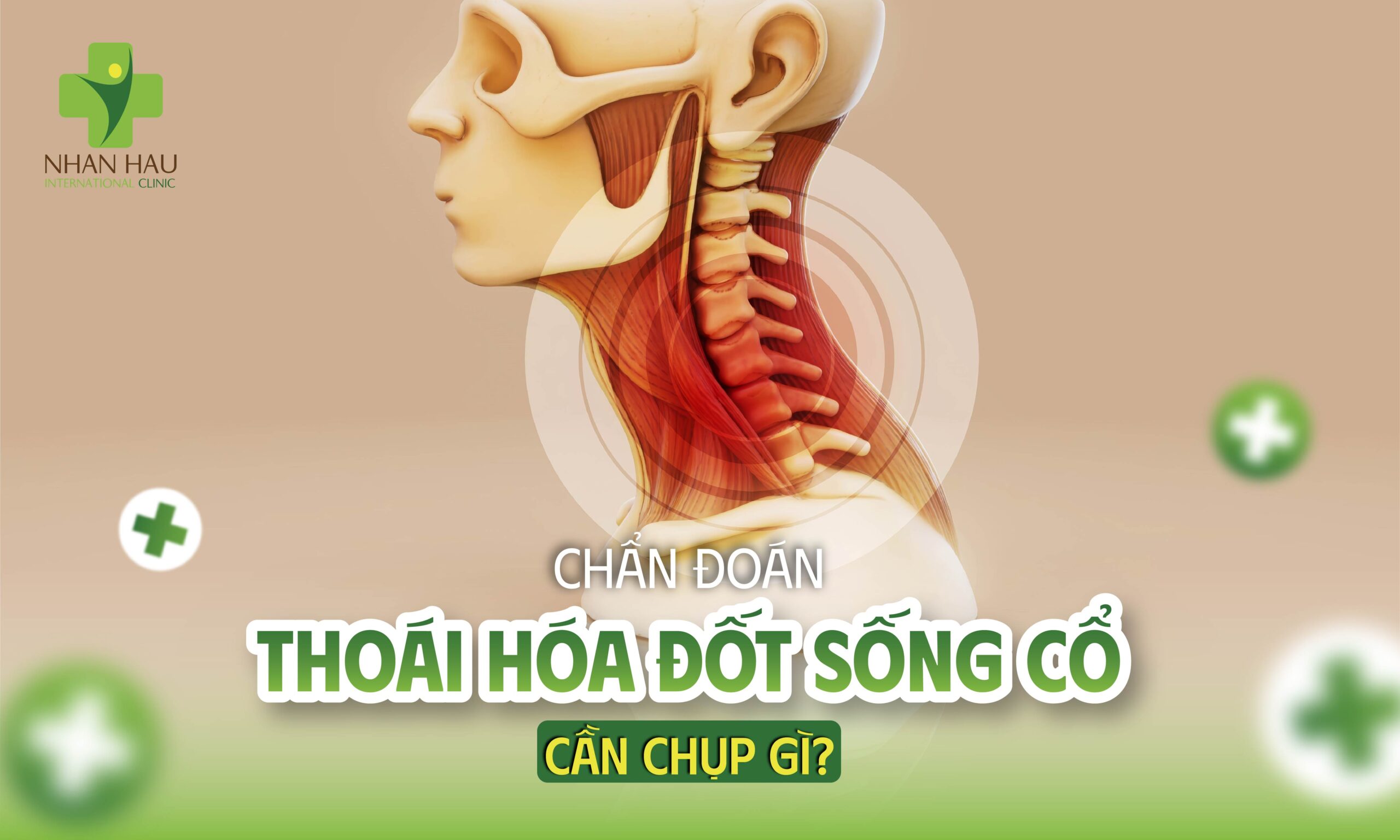 Chẩn Đoán Thoái Hóa Đốt Sống Cổ — Cần Chụp Gì?