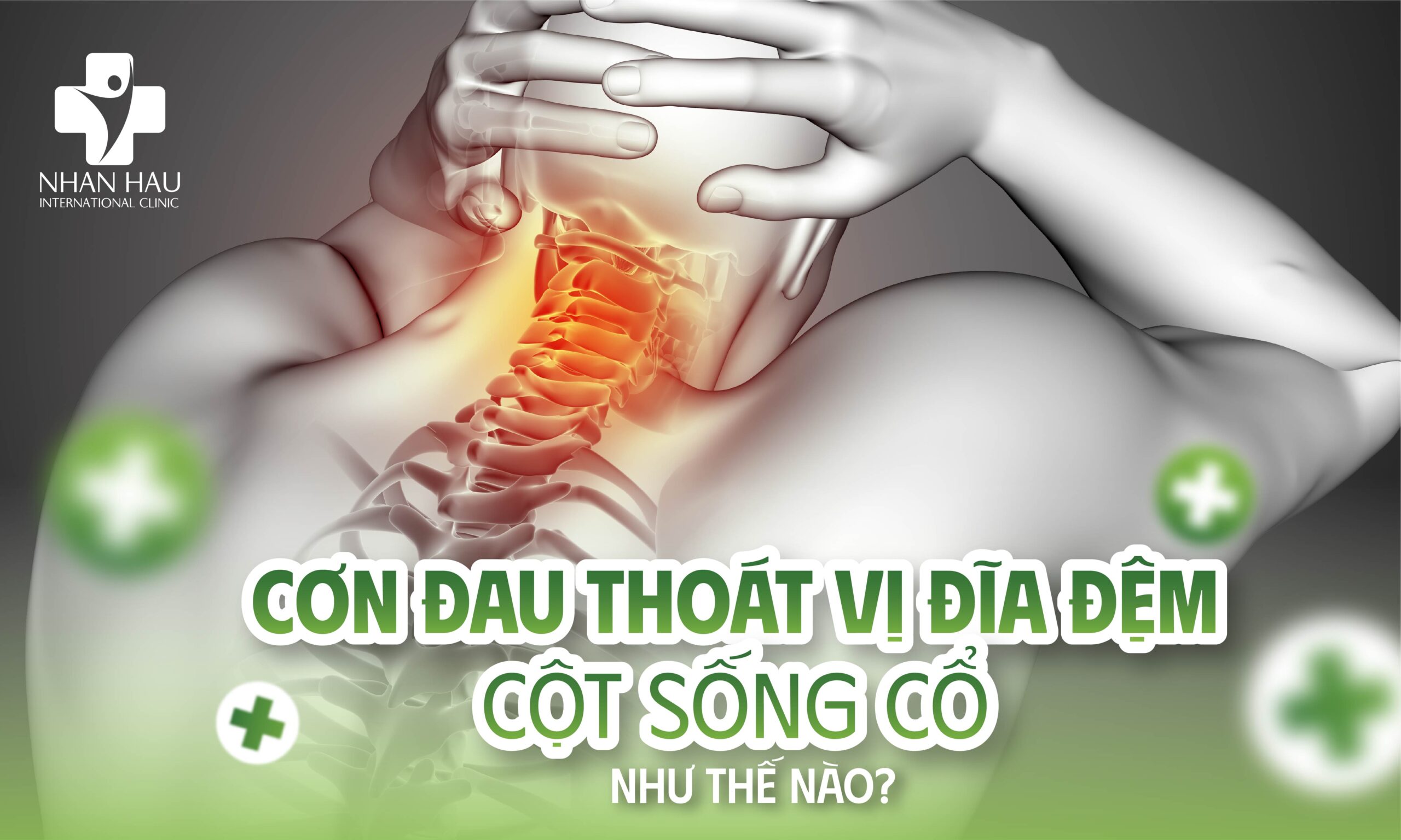 Cơn Đau Thoát Vị Đĩa Đệm Cột Sống Cổ Như Thế Nào?