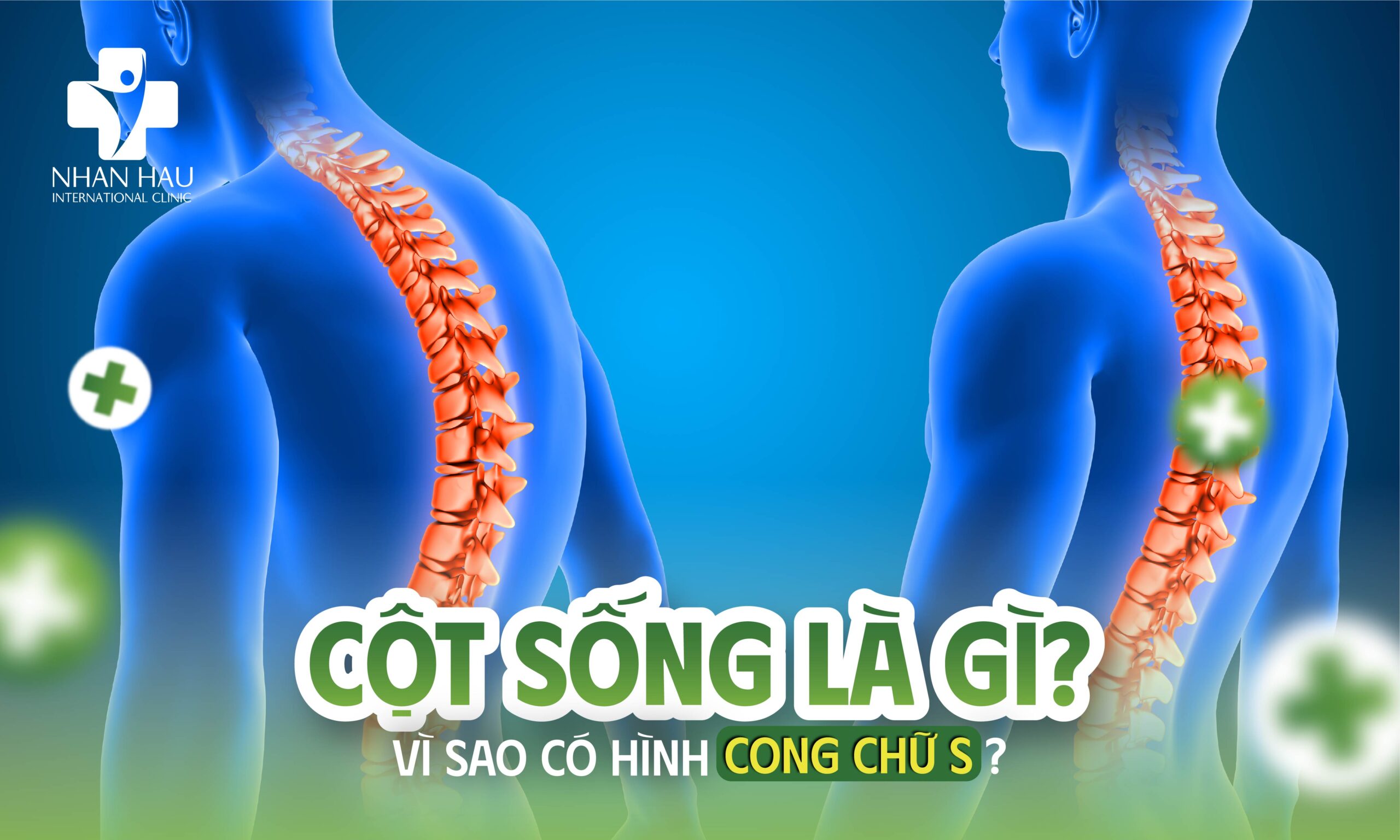 Cột Sống Là Gì Vì Sao Có Hình Cong Chữ S