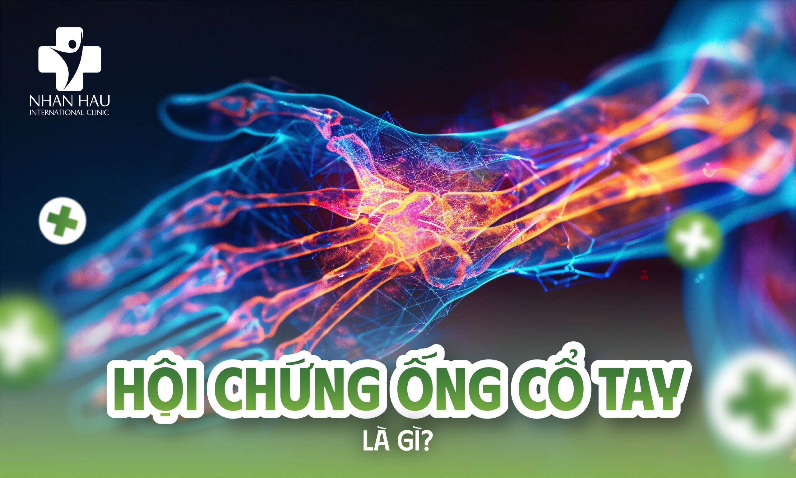 Hội Chứng Ống Cổ Tay Là Gì?