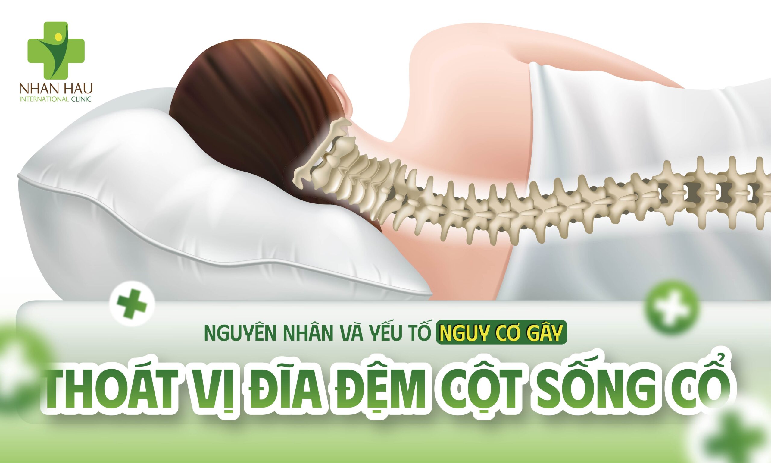 Nguyên Nhân Và Yếu Tố Nguy Cơ Gây Thoát Vị Đĩa Đệm Cột Sống Cổ