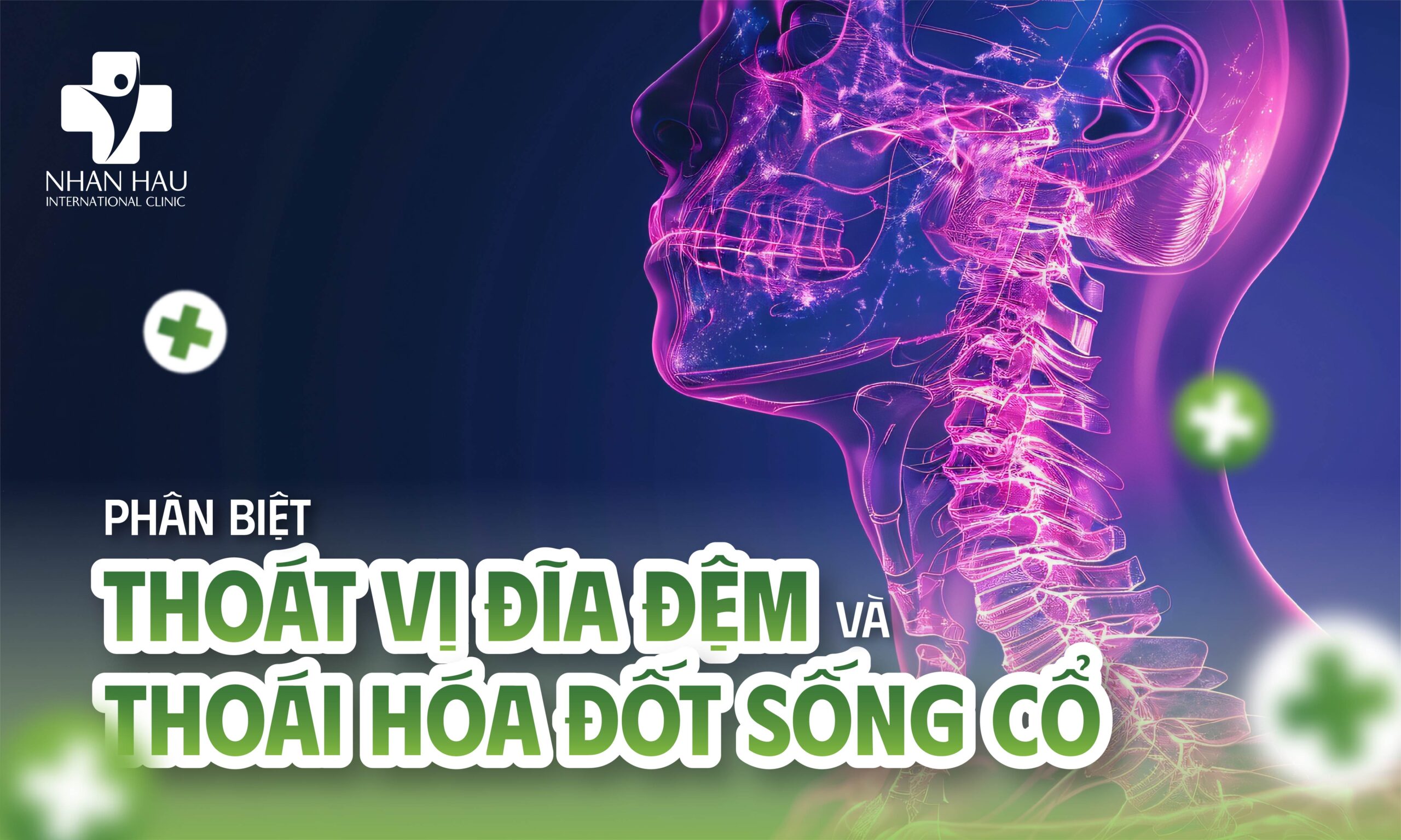 Phân Biệt Thoát Vị Đĩa Đệm Với Thoái Hóa Đốt Sống Cổ