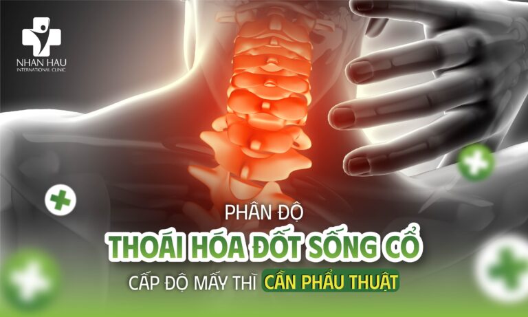 Phân Độ Thoái Hóa Đốt Sống Cổ - Cấp Độ Mấy Thì Cần Phẫu Thuật?
