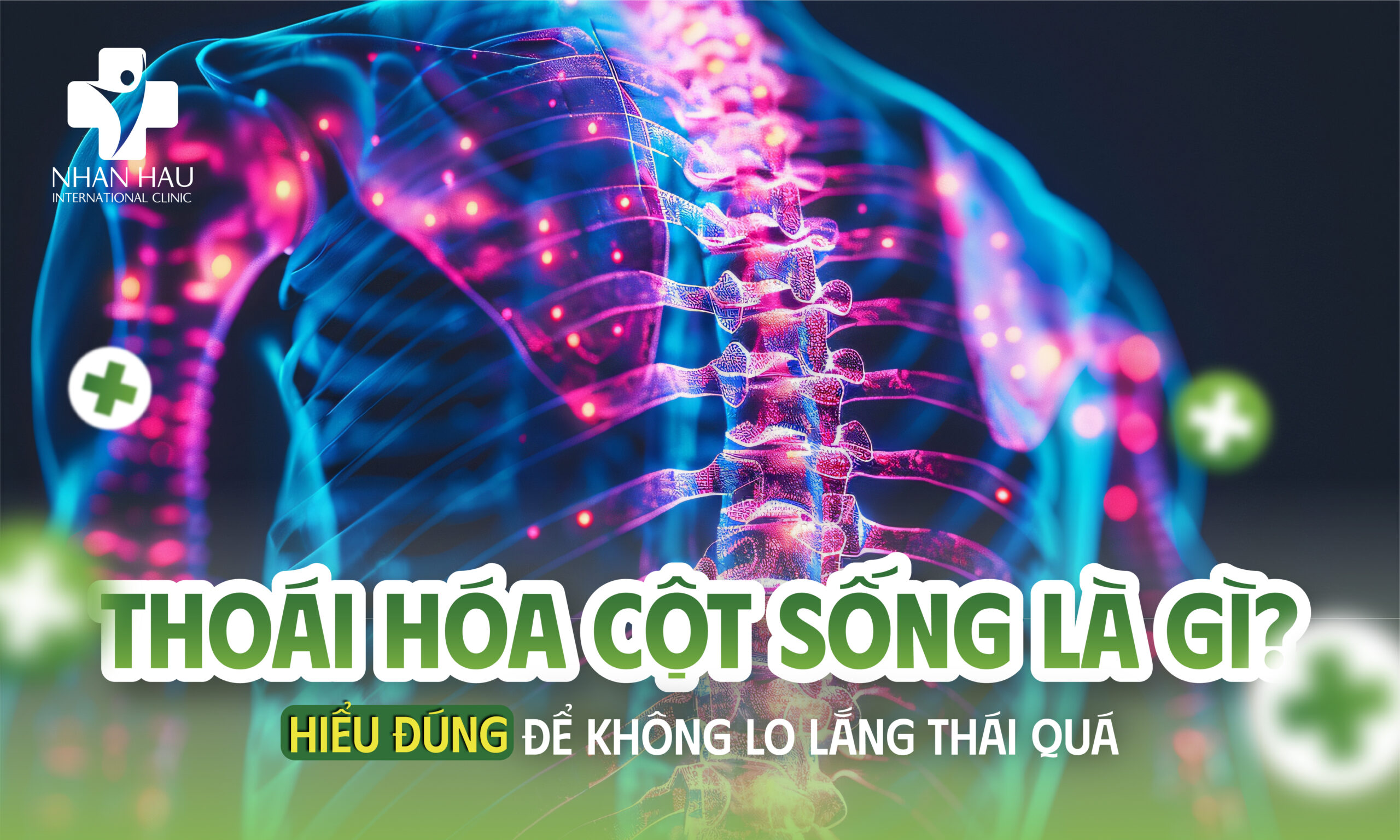 Thoái Hóa Cột Sống Là Gì? Hiểu Đúng Để Không Lo Lắng Thái Quá