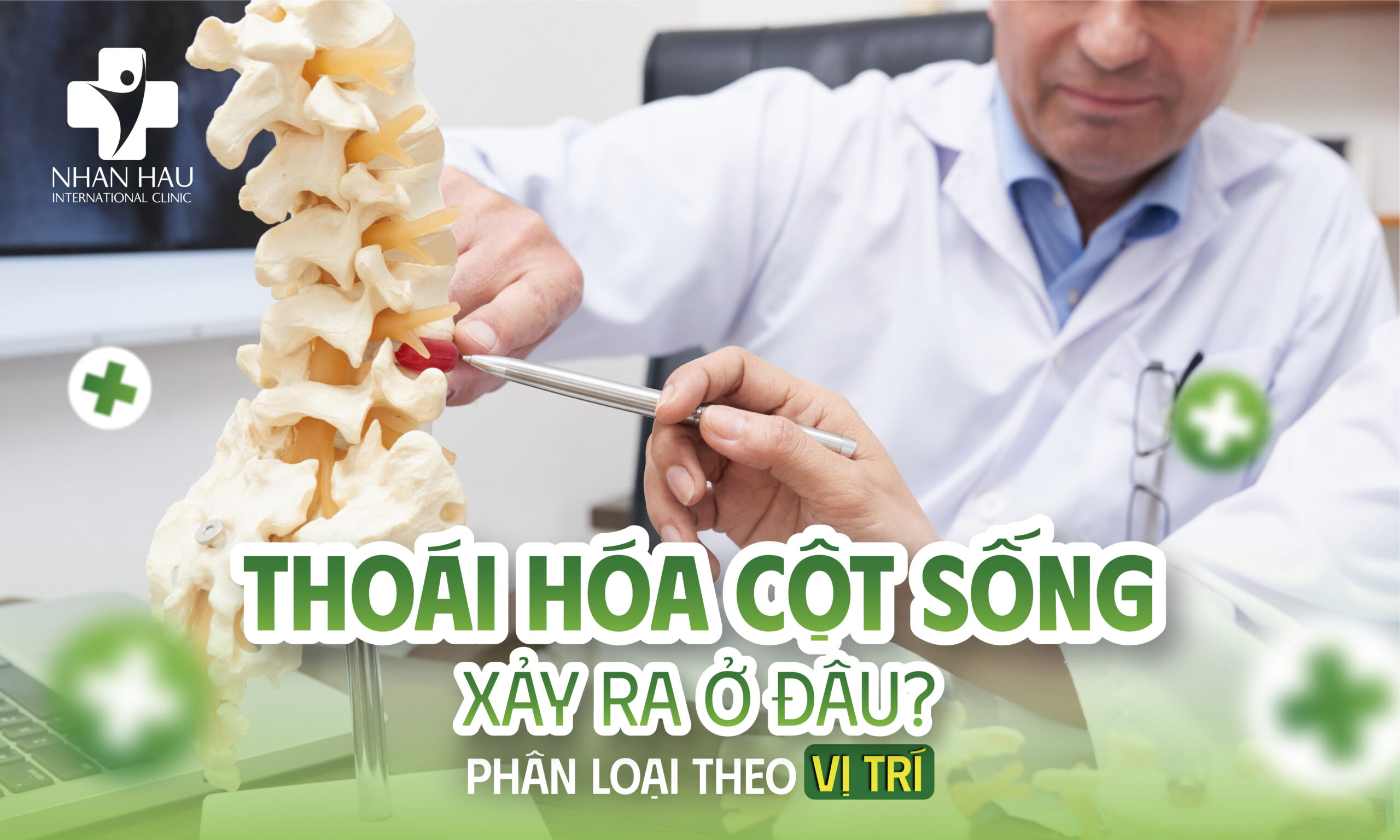 Thoái Hóa Cột Sống Xảy Ra Ở Đâu? Phân Loại Theo Vị Trí