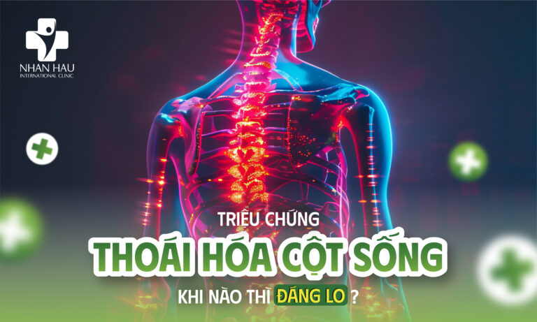 Triệu Chứng Thoái Hóa Cột Sống: Khi Nào Thì Đáng Lo?