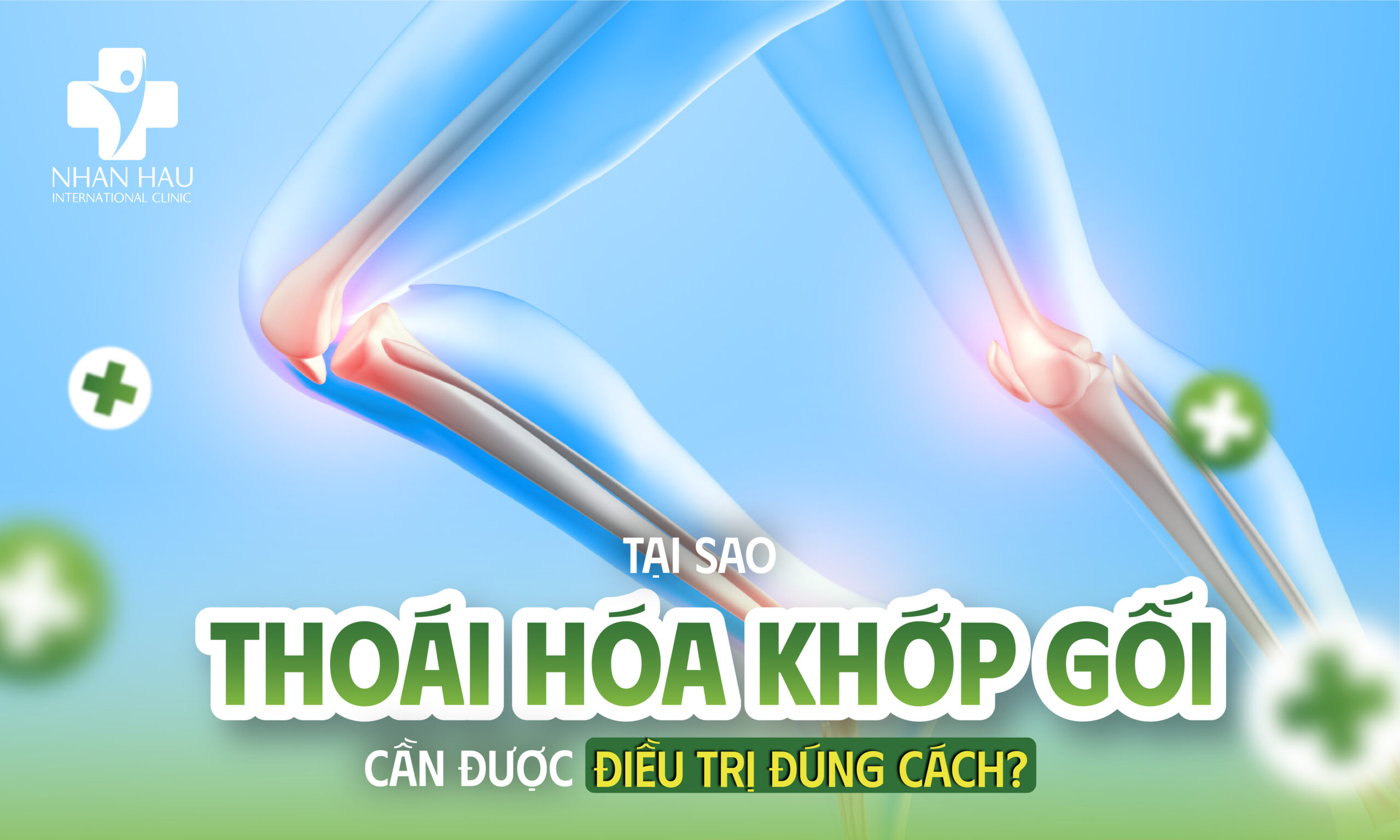 Điều Trị Thoái Hóa Khớp Gối: Phác Đồ Toàn Diện Theo Từng Giai Đoạn 1 Tại sao thoái hóa khớp gối cần được điều trị đúng cách?