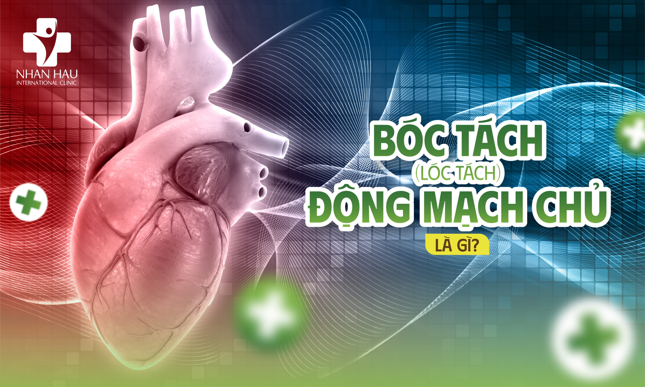 Bóc tách (lóc tách) động mạch chủ là gì?