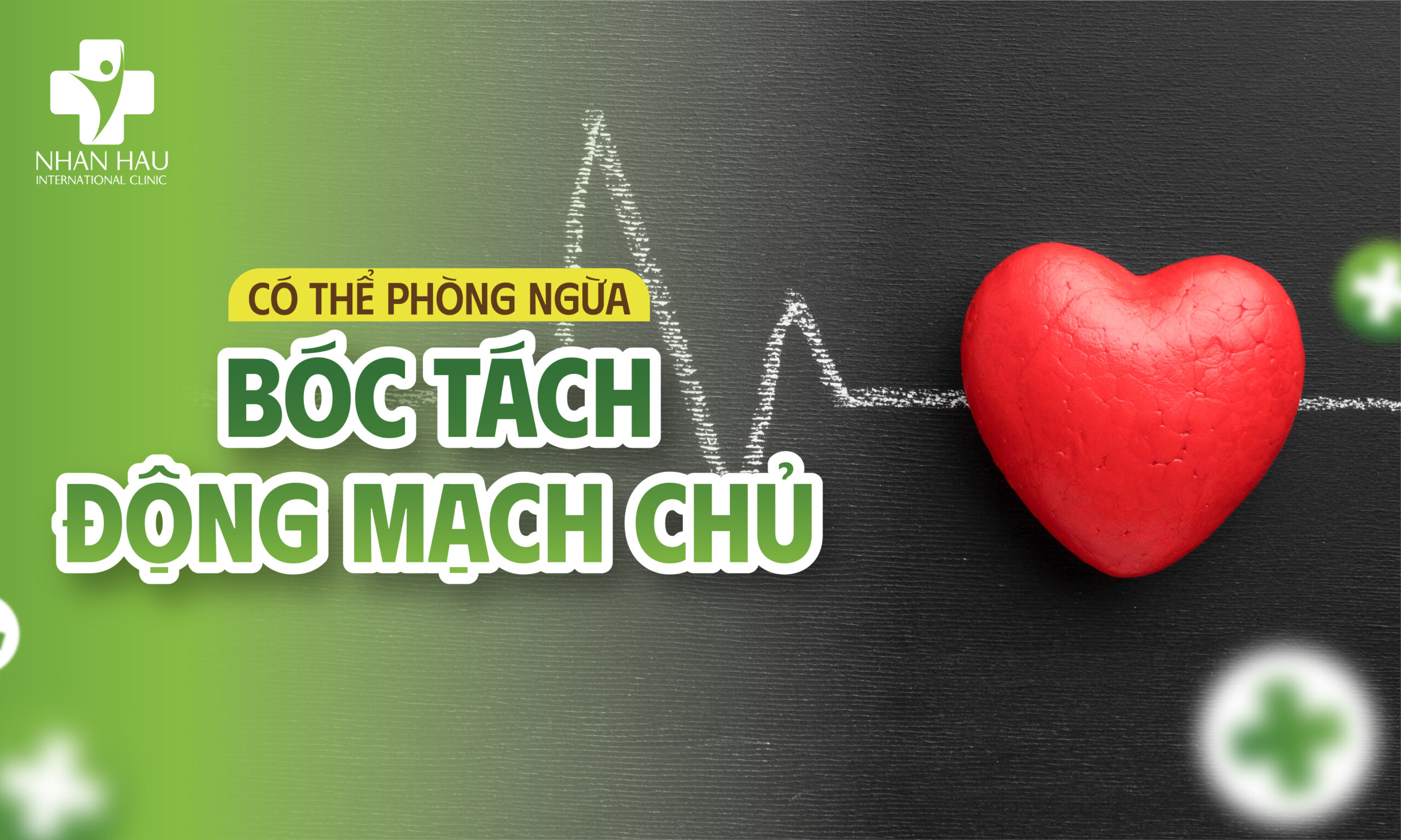 Có thể phòng ngừa bóc tách động mạch chủ không?