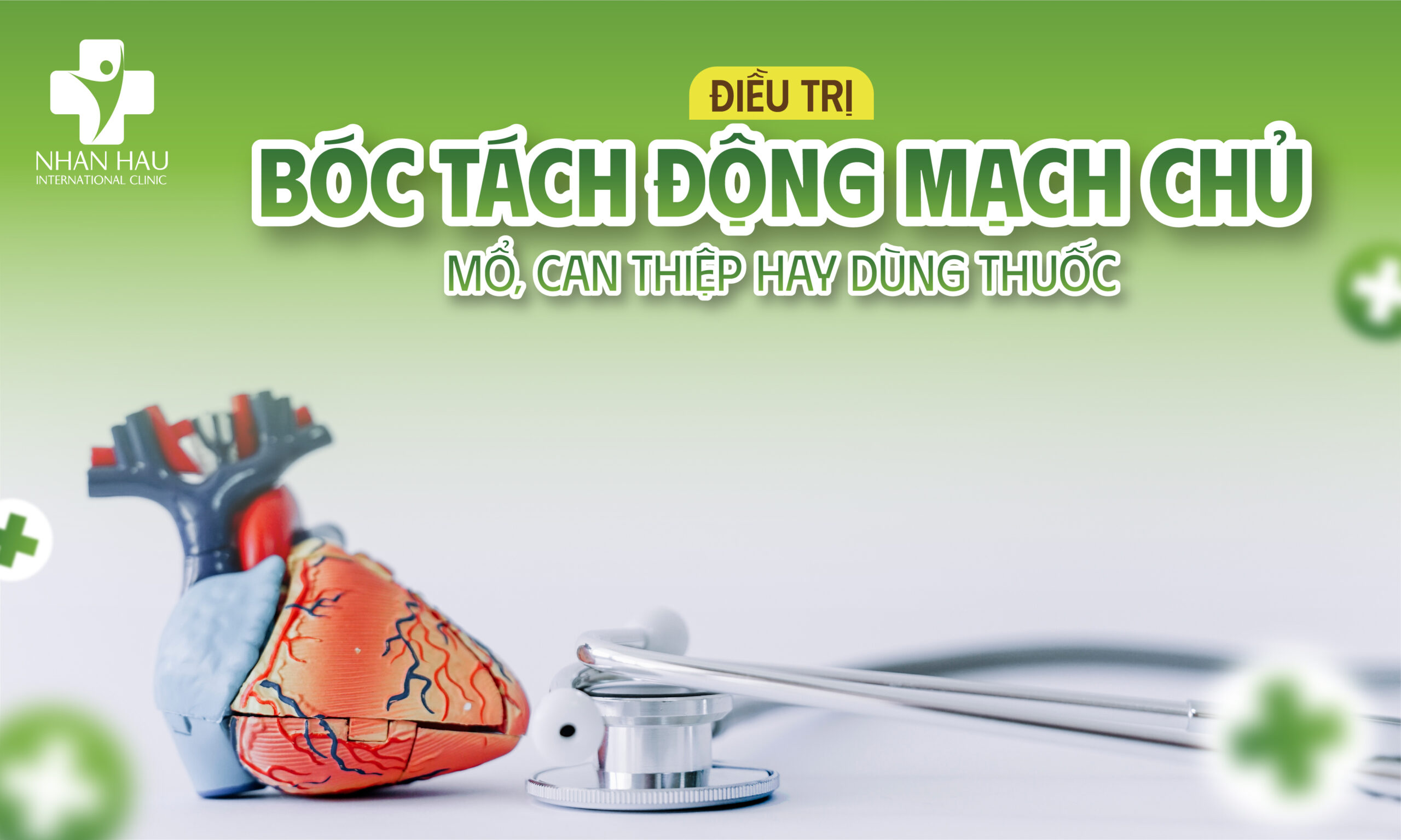 Điều trị bóc tách động mạch chủ: mổ, can thiệp hay dùng thuốc?