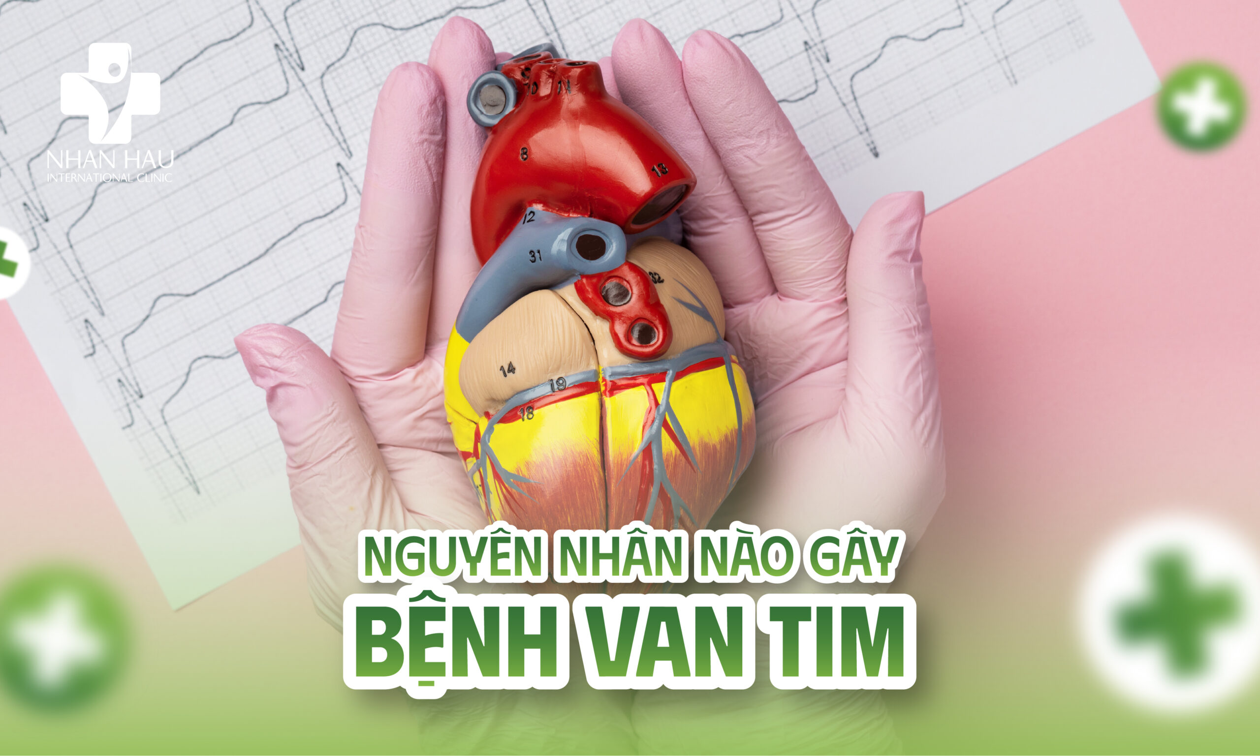 Bệnh Van Tim: Dấu Hiệu, Nguyên Nhân, Chẩn Đoán và Điều Trị 4 Nguyên nhân nào gây bệnh van tim?