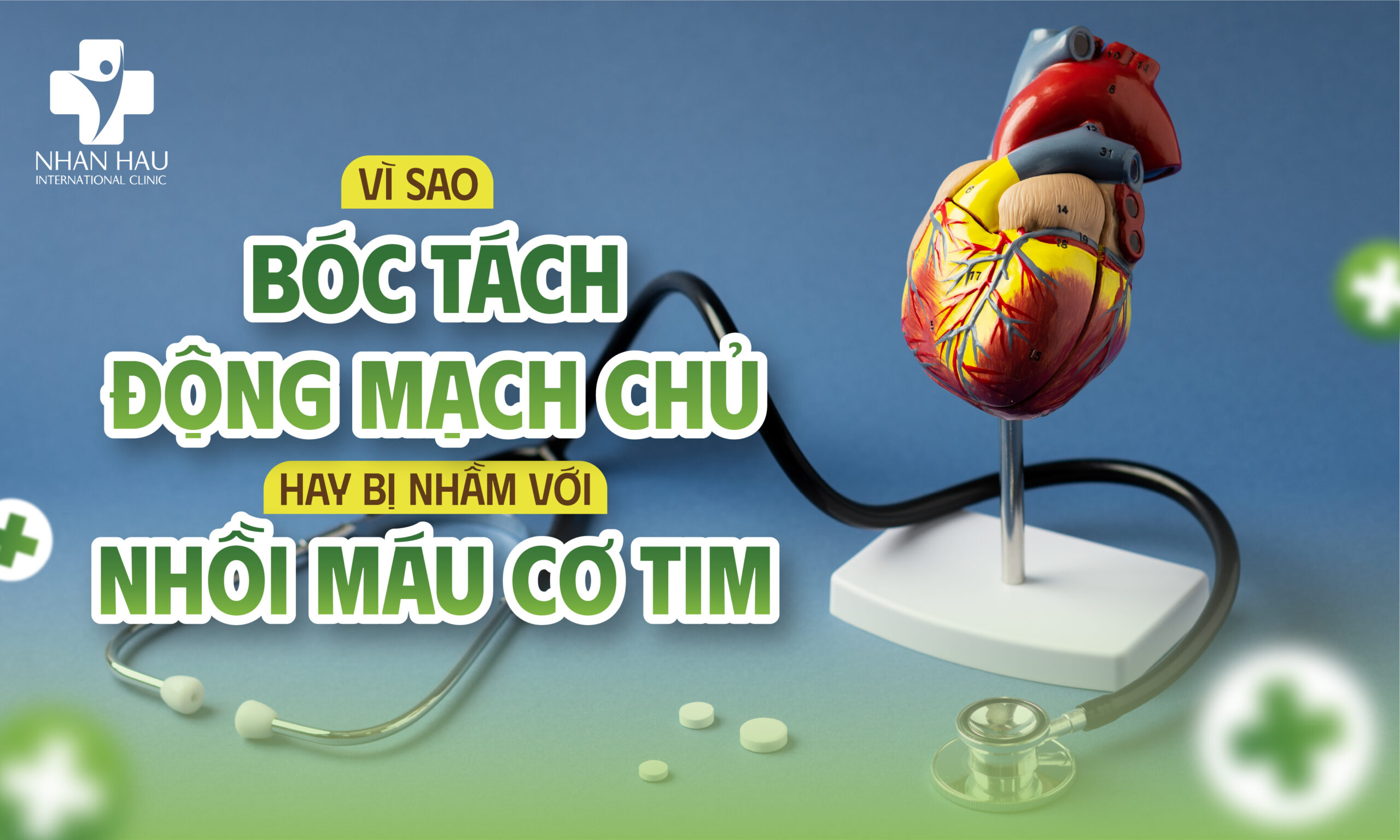 Vì sao bóc tách động mạch chủ hay bị nhầm với nhồi máu cơ tim?
